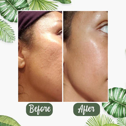 GREEN MASK - ELIMINA IMPUREZAS DEL ROSTRO